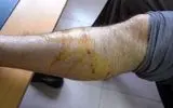  آمار بالای حیوان گزیدگی در اردبیل/ 7500 مورد طی 1403 ثبت شد