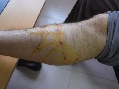  آمار بالای حیوان گزیدگی در اردبیل/ 7500 مورد طی 1403 ثبت شد