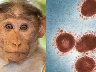  مرکزی برای مقابله با آبله میمون آمادگی نسبی دارد 