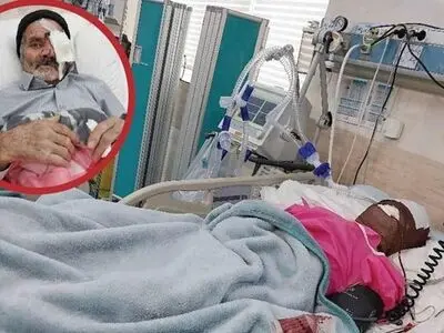 مجروح شدن یک دامدارِ الموتی بر اثر حمله پلنگ 