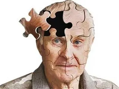 پیشگیری از آلزایمر امکان‌پذیر است

