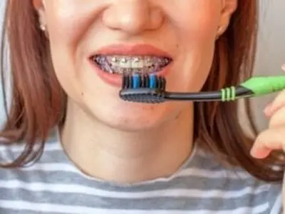 نحوه استریل کردن مسواک برای جلوگیری از بیماری ها