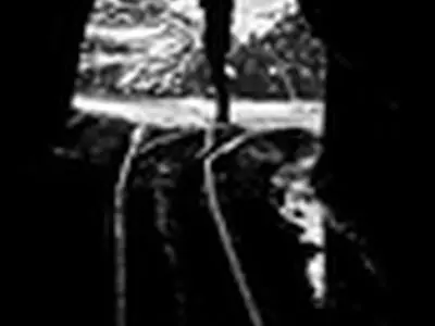 ۷ کارگر معدن «چشمه پودنه» اخراج شدند / تلفات اعتصاب به ۹ نفر رسید