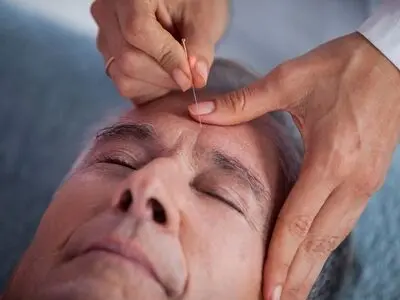 طب سوزنی روشی موثر برای جوانسازی و زیبایی شما!
