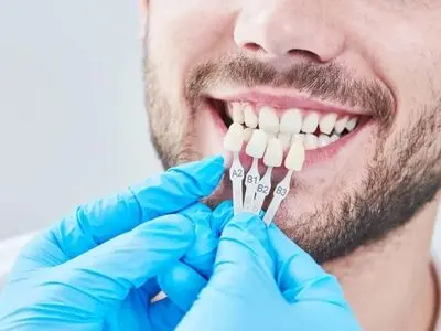 تفاوت لمینت و کامپوزیت دندان چیست؟
