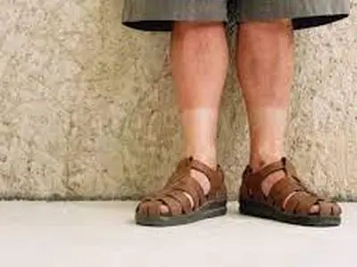 5 روش رایج برای جلوگیری از آفتاب سوختگی ساحلی در سفر