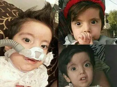 پرداخت هزینه‌‌های گزاف بابت درمان/مسئولان دین خود را به بیماران نادر ادا کنند