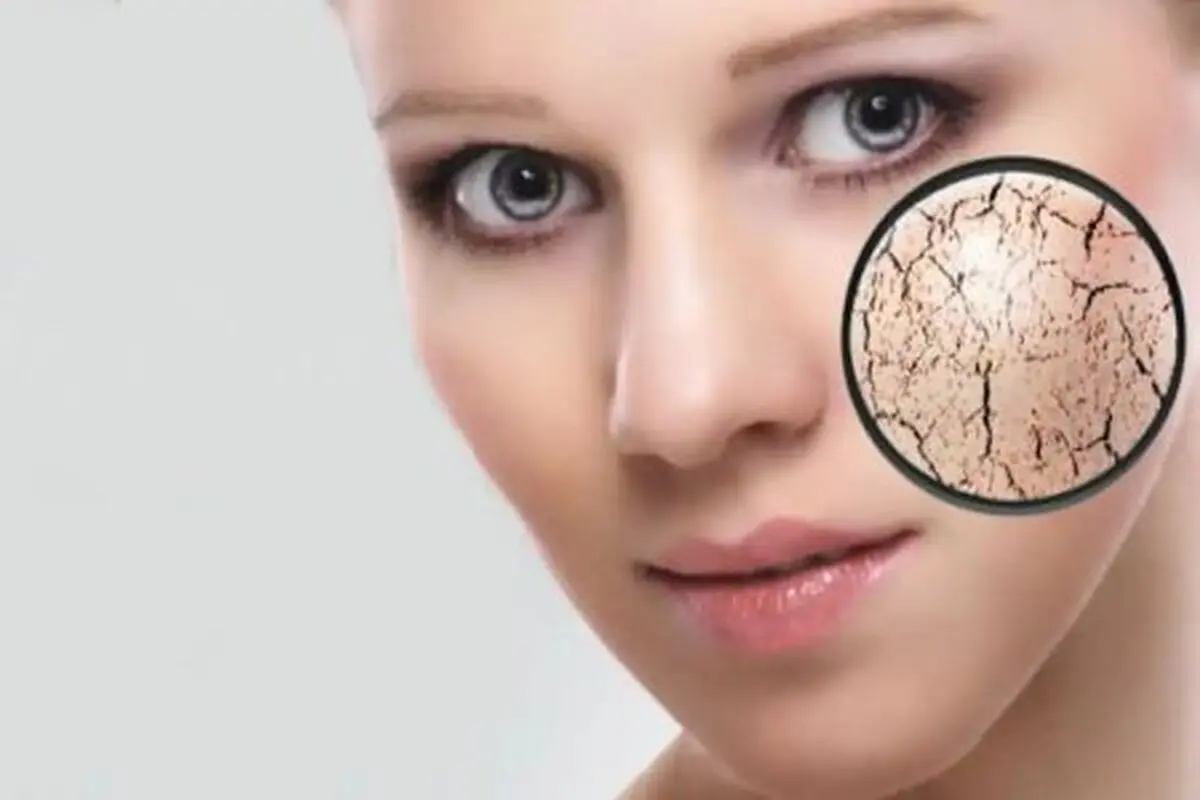 روش پاکسازی پوست خشک در منزل