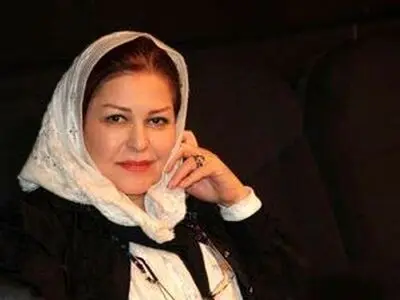 تغییر ظاهر مشهود خانم بازیگر/عکس
