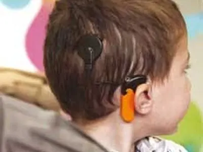 ازدواج فامیلی از دلایل نقص شنوایی نوزادان است
