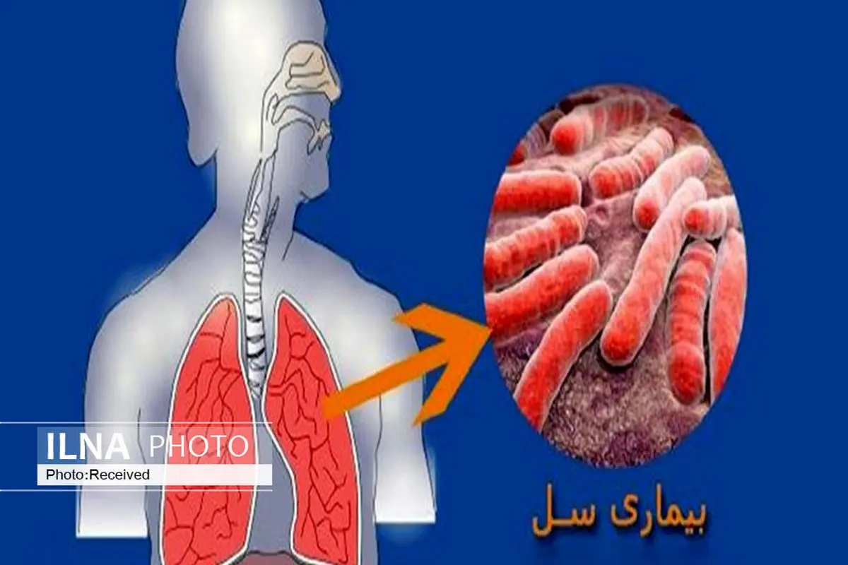 9 هزار نفر از اتباع افغانستان در قزوین تحت غربالگری بیماری سل قرار می‌گیرند