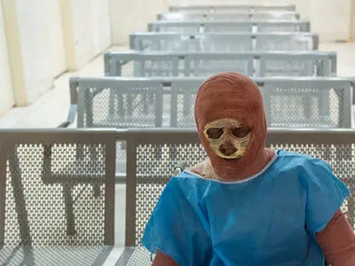 کاهش آمار فوت‌شدگان ناشی از سوختگی در دولت یازدهم/ بیمارستان‌ها هزینه داروی بیماران را پرداخت می‌کنند