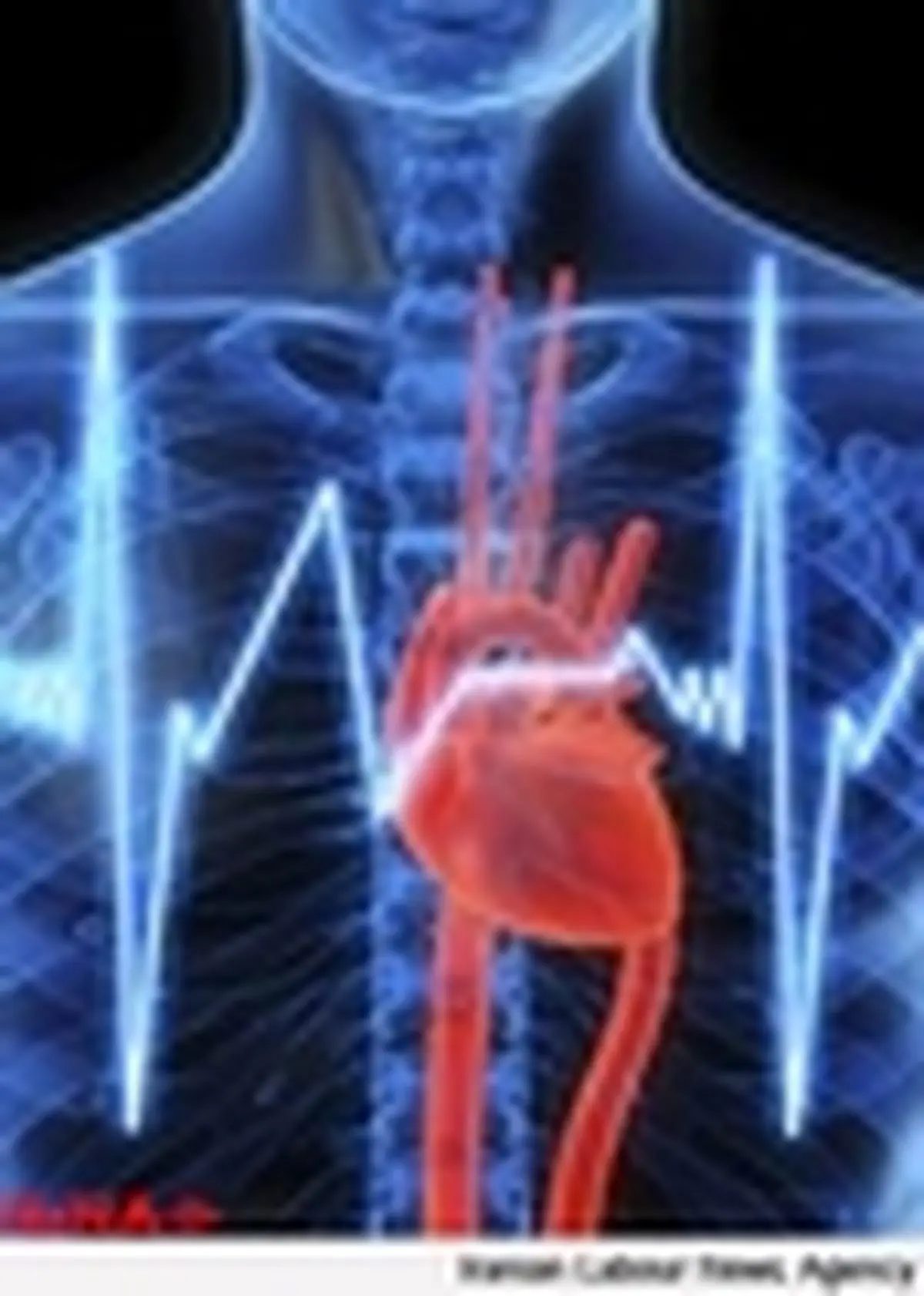 شیوع بالای نارسایی‌های قلبی در کشور / ‌آلودگی هوا؛ سهم مهلک برای بیماران قلبی
