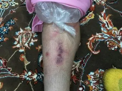  پای خلعتبری و پنالتی ذوب آهن