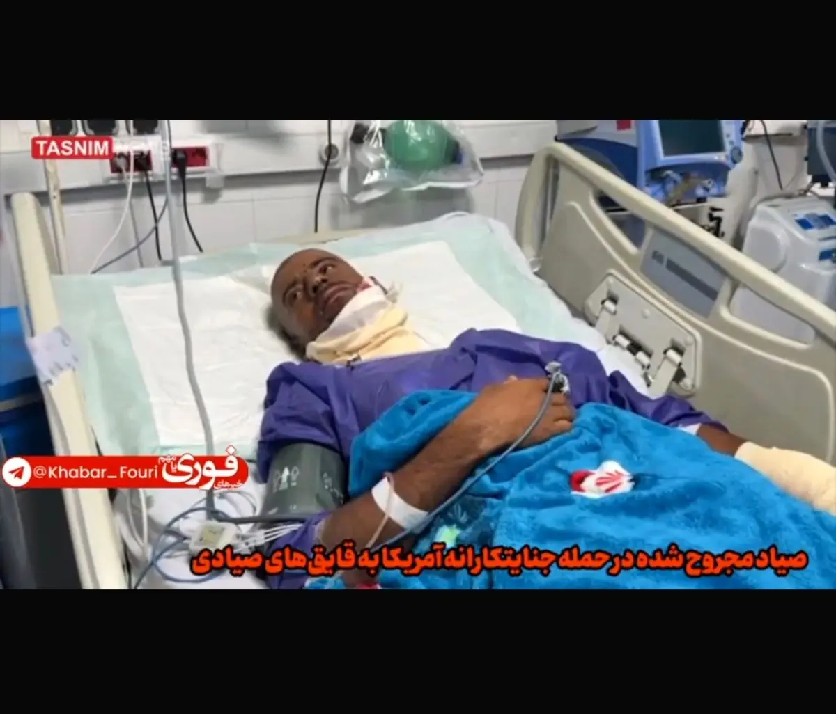اولین تصاویر از صیاد مجروح حمله آمریکا به قایق‌های صیادی + فیلم