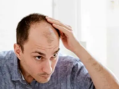 این گیاه چینی باعث رشد مجدد مو می شود