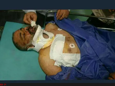 تشریح جزئیات حادثه حمله به محیط‌بانان شهرستان امیدیه/ ضاربان ناشناس هستند