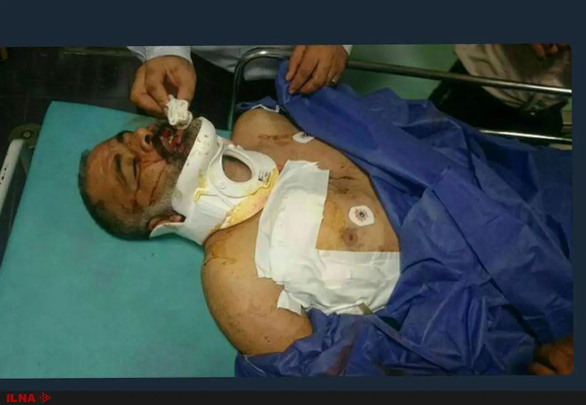 تشریح جزئیات حادثه حمله به محیط‌بانان شهرستان امیدیه/ ضاربان ناشناس هستند