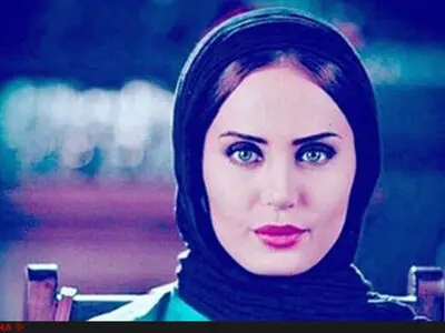 آخرین وضعیت الناز شاکردوست در بیمارستان+عکس