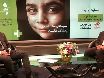 نشست خبری روز ملی-مردمی پیشگیری از سوختگی