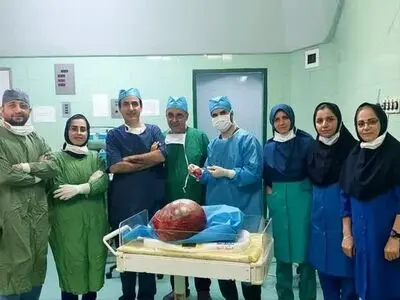 خارج کردن توده ۶ کیلویی از شکم بیمار آملی+فیلم