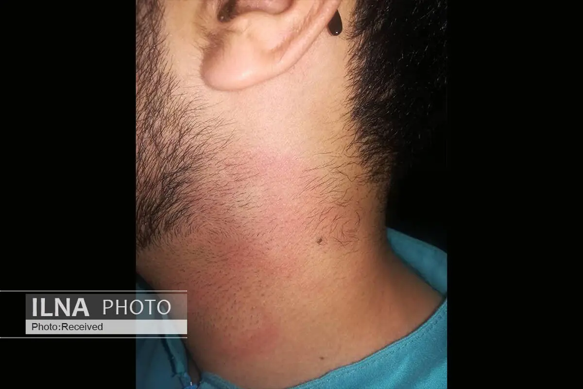 ضرب و شتم پرستار شیرازی توسط پزشک/ جلوی این «خود برتربینی» را بگیرید!