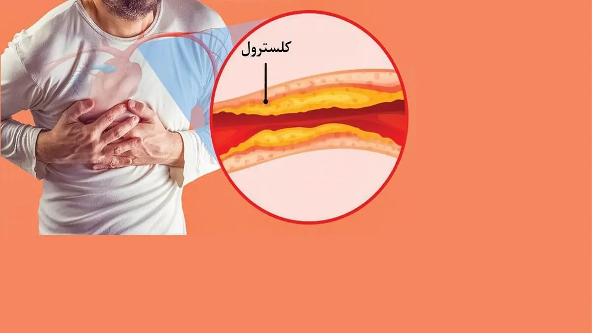 ۶ نشانه خاموش و خطرناک گرفتگی رگ‌ها