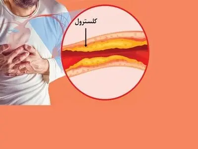 ۶ نشانه خاموش و خطرناک گرفتگی رگ‌ها
