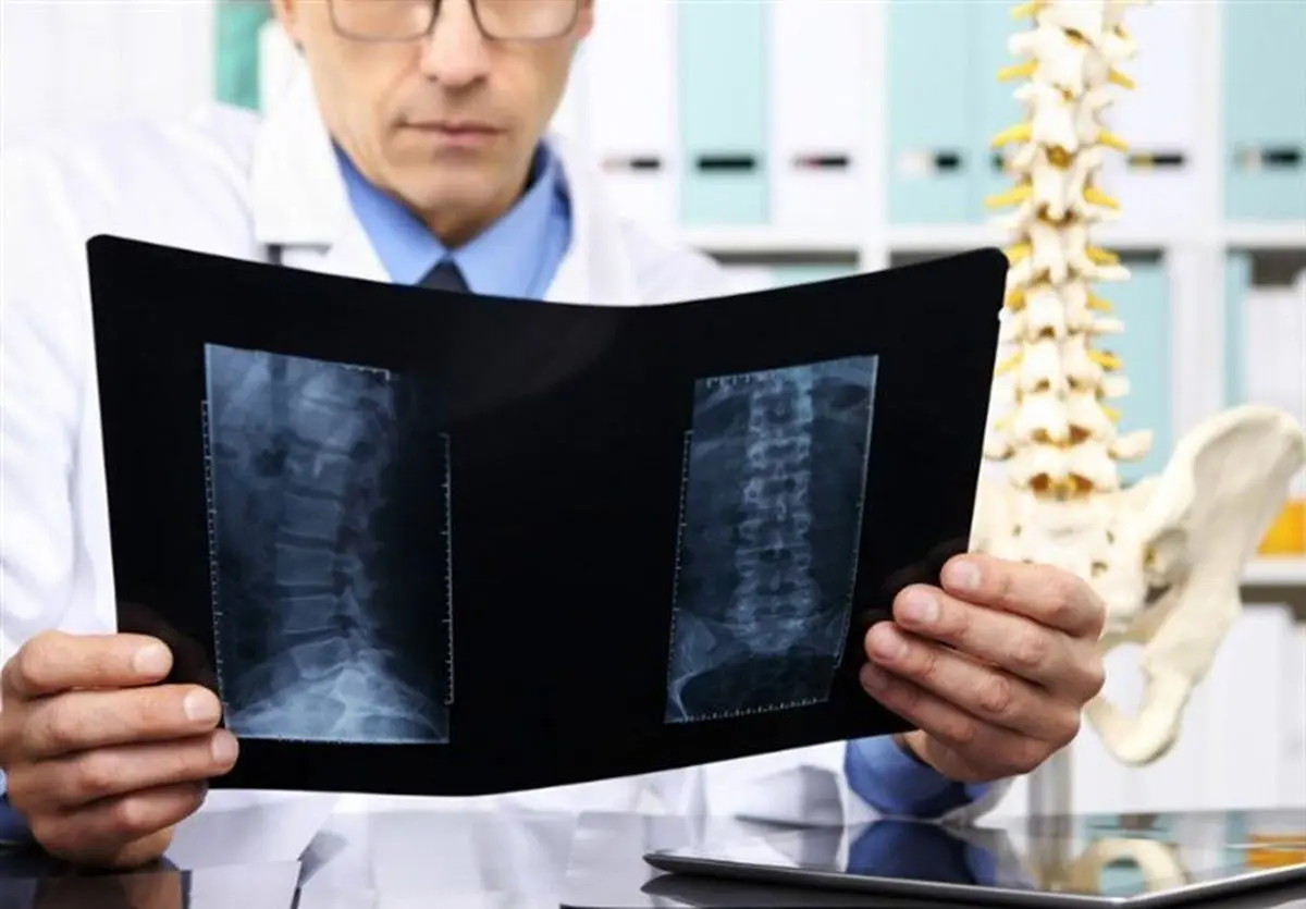 ۵ روش عالی برای داشتن استخوان‌های محکم و سالم