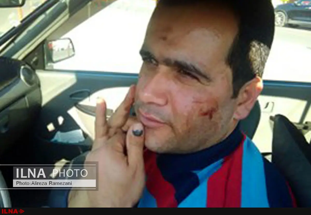 مصدومیت یک کارگر براثر ضرب و شتم ماموران منتسب به شهرداری رشت 