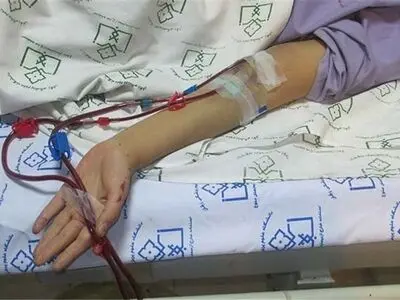 توقف توزیع داروی «مایفورتیک»؛  برخی بیماران پیوندی در معرض خطر رد عضو