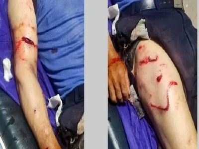 مصدومیت یک کارگر ۵۸ ساله بر اثر حمله خرس