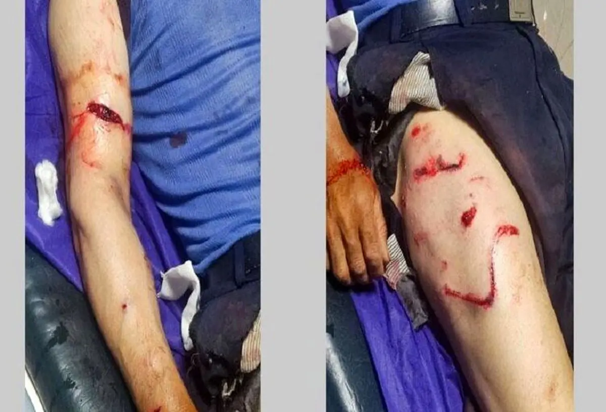 مصدومیت یک کارگر ۵۸ ساله بر اثر حمله خرس