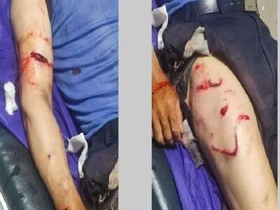 مصدومیت یک کارگر ۵۸ ساله بر اثر حمله خرس