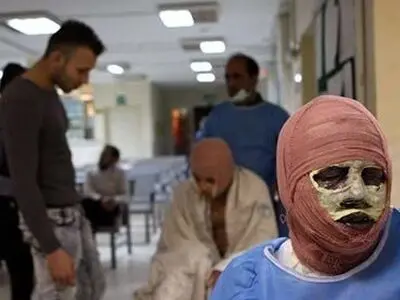 چهارشنبه پایان سال و حوادث پی در پی / یک مرگ و 2 سوختگی در یک روز 