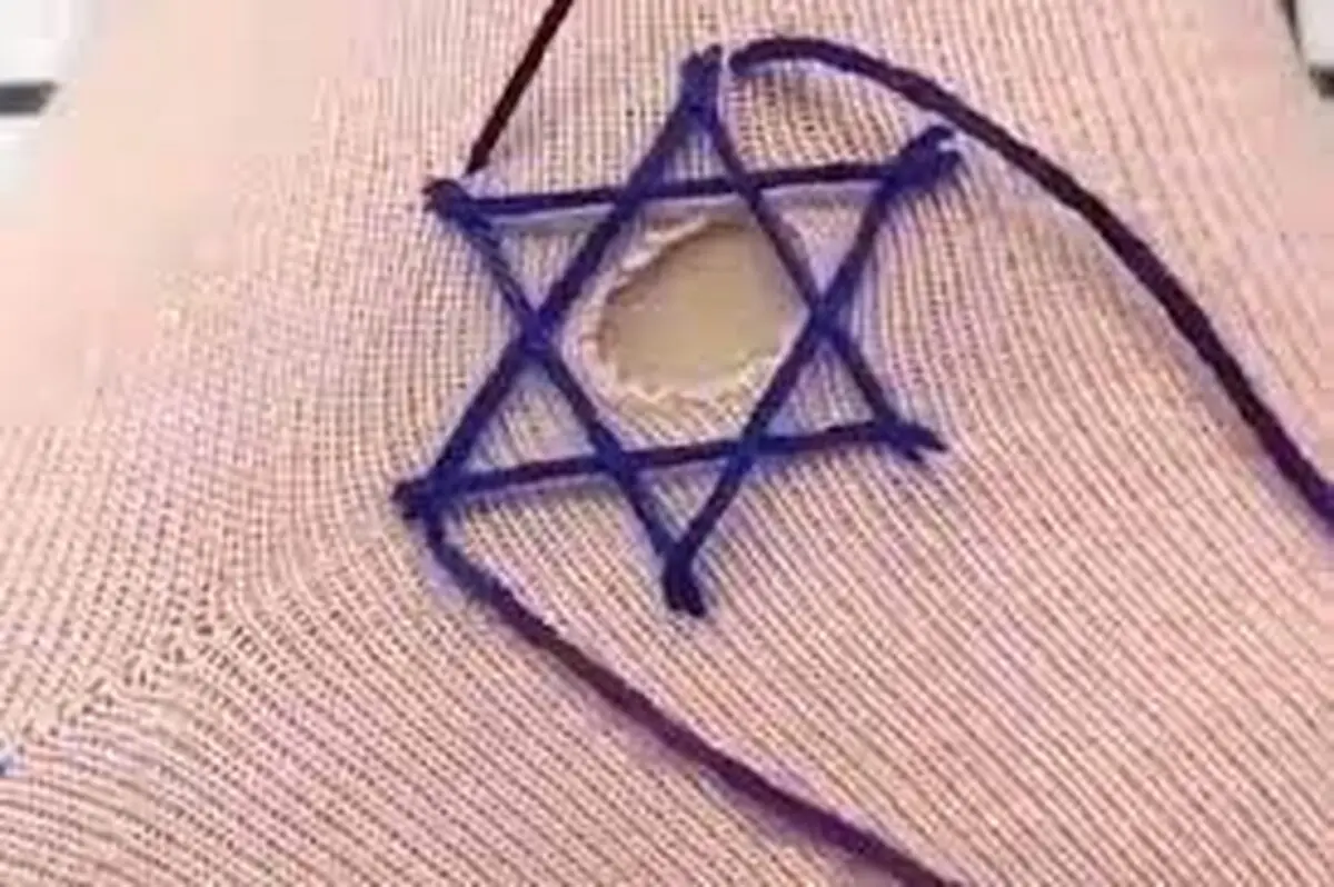 روش ترمیم ژاکت سوراخ شده/ فیلم