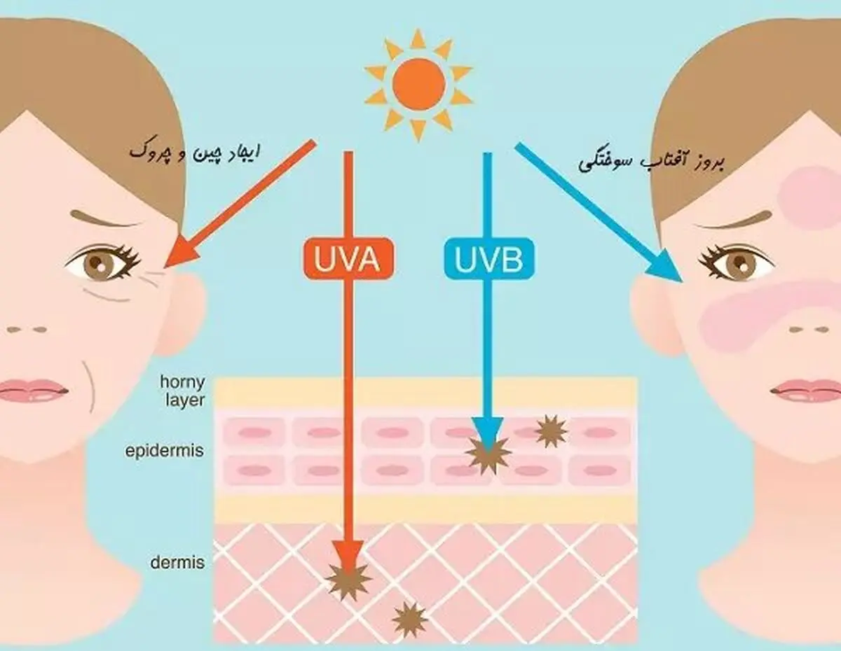 راه‌های پیشگیری از آسیب‌زایی اشعه UV بر پوست و مو/ توضیحات یک دکترای صلاحیت حرفه‌ای پوست و مو