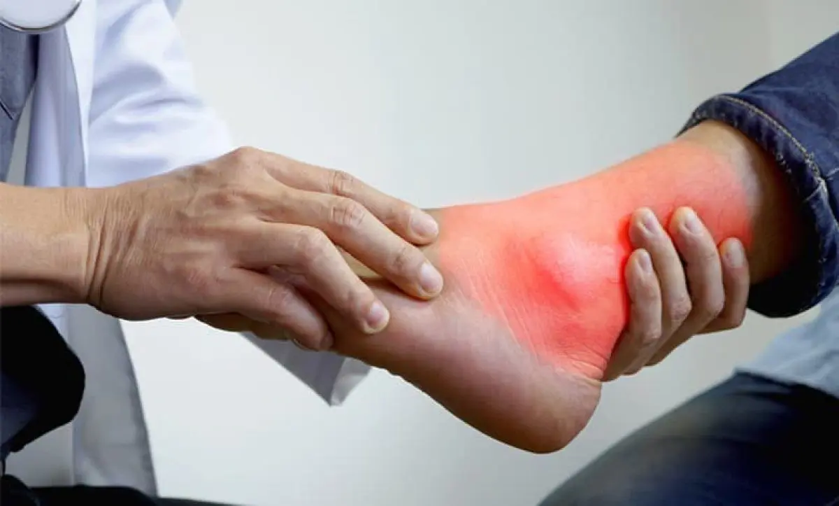هنگام حمله نقرس چه باید کرد؟
