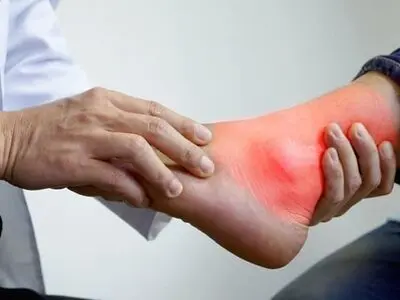هنگام حمله نقرس چه باید کرد؟