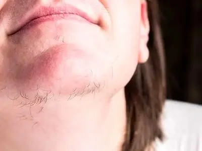 asdasd