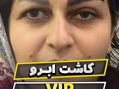 هزینه کاشت ابرو در تهران