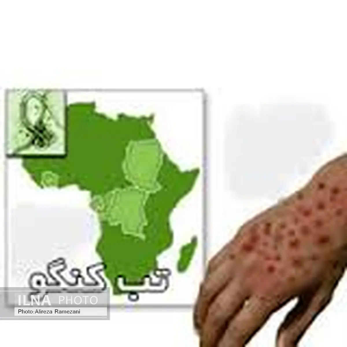 موردی از تب کریمه کنگو در مازندران مشاهده نشده است