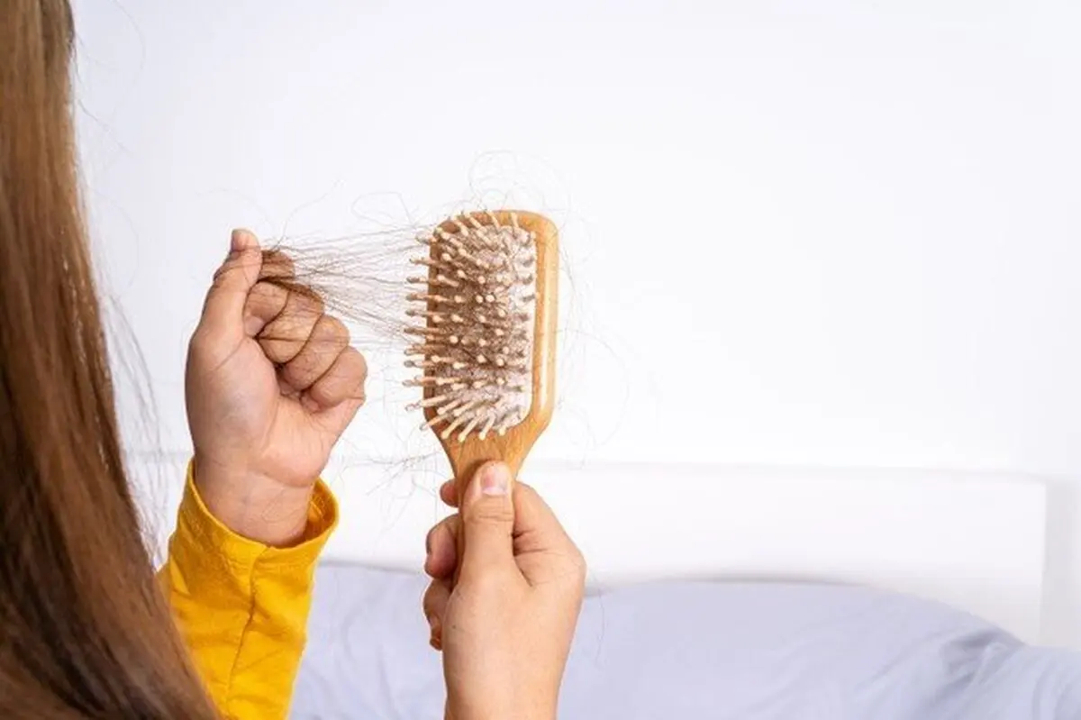 این غذاها را نخورید تا ریزش مو نگیرید