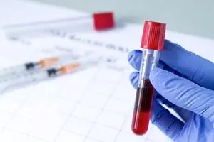 راهنمای کامل آزمایش خون + جدول