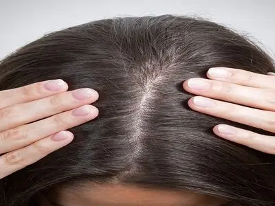 افزایش تراکم مو با چند روش خانگی