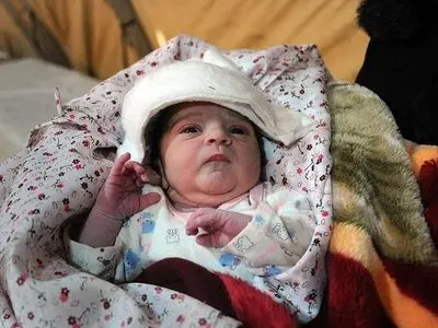 نجات جان نوزاد ۹ روزه در شوش از مرگ حتمی 