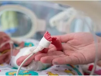 آندوسکوپی نوزاد ۲ کیلوگرمی در بندرعباس