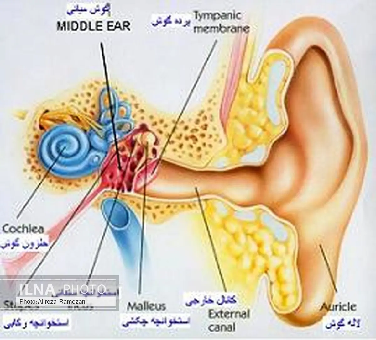 با این مواد غذایی وزوز گوشتان را درمان کنید