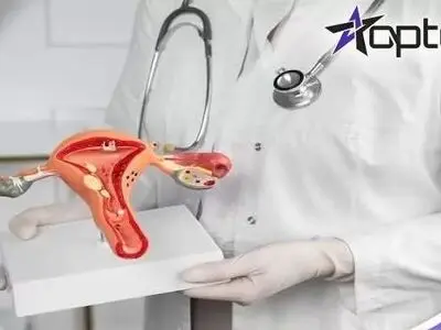 شایع ترین بیماری های زنان در همه سنین! [آپدیت 2023]