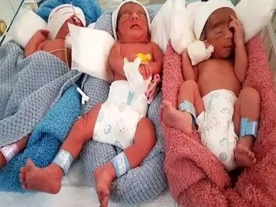 ثبت نخستین سه‌قلوزایی امسال 